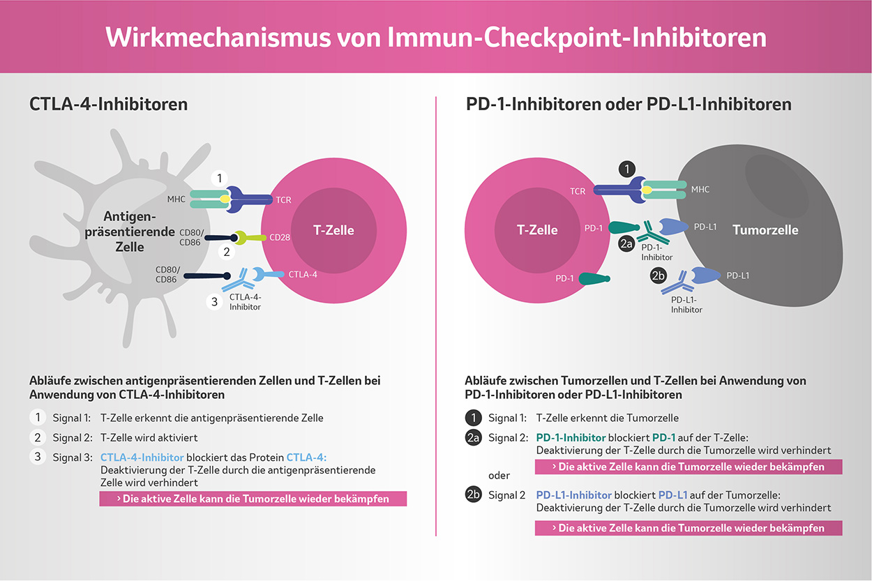 Immunonkologische Behandlungsoptionen