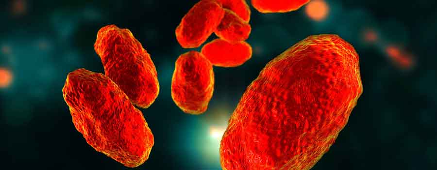 Bakterium Haemophilus influenzae Typ b (Hib)